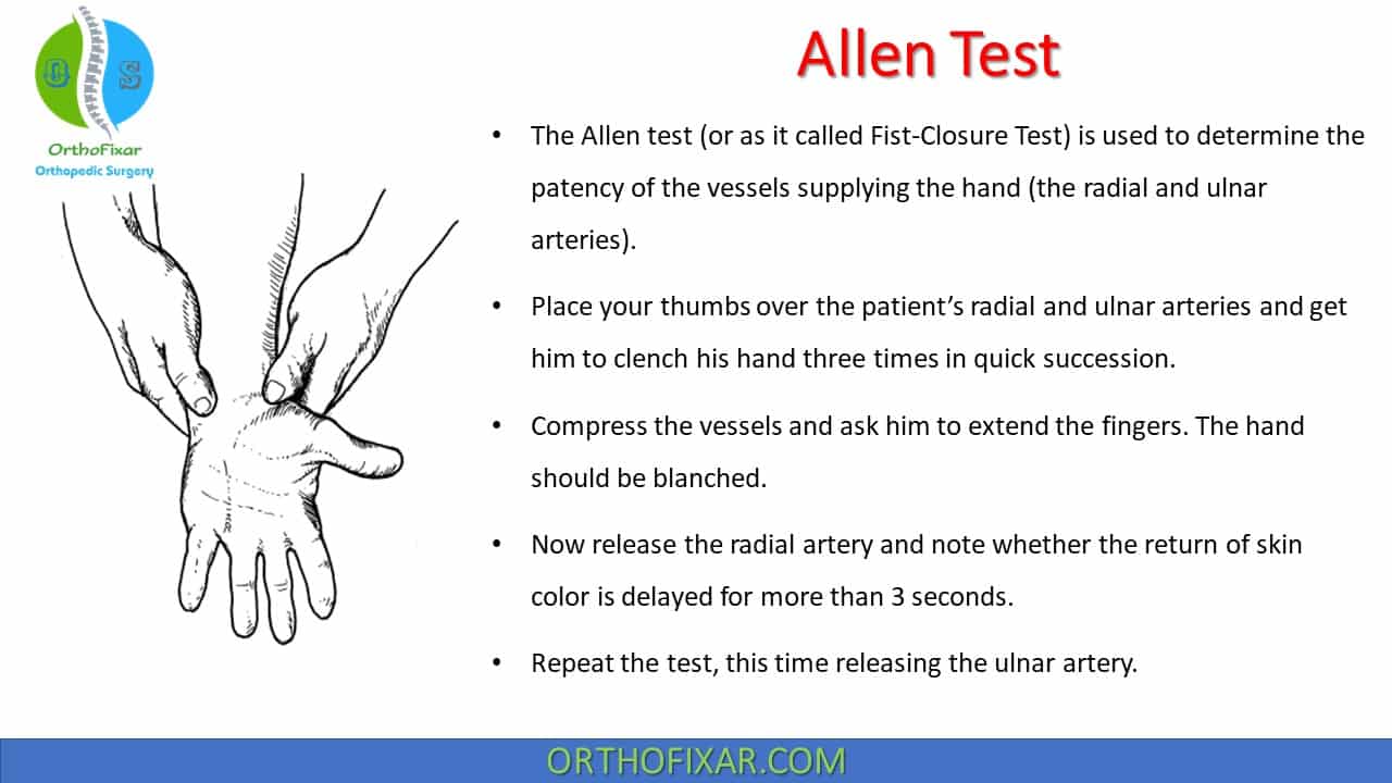  Allen Test 