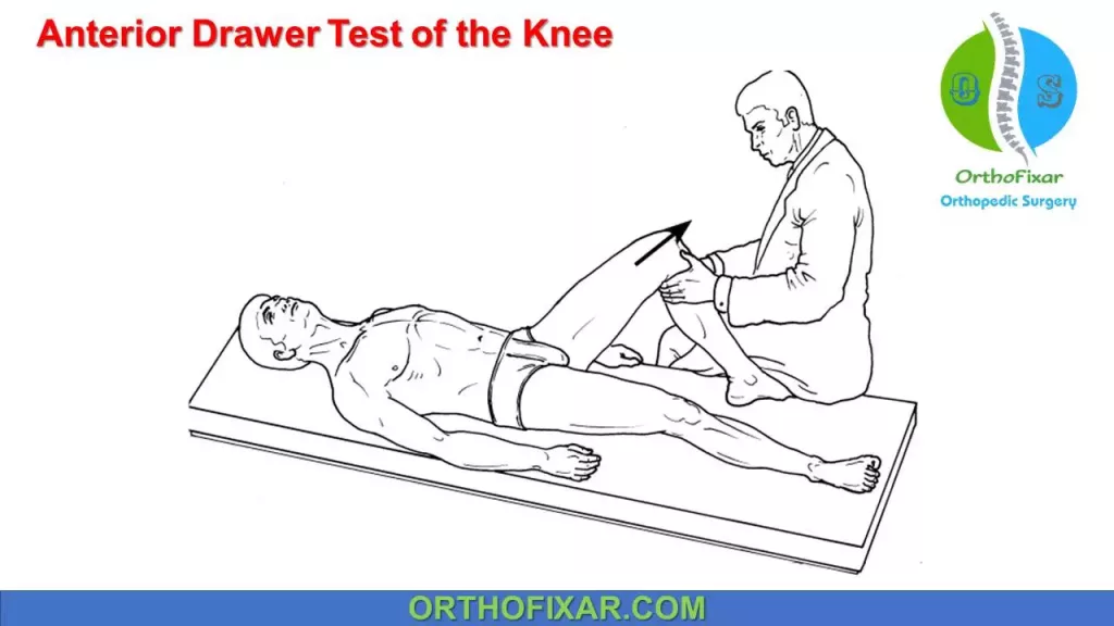 Anterior Drawer Test of the Knee