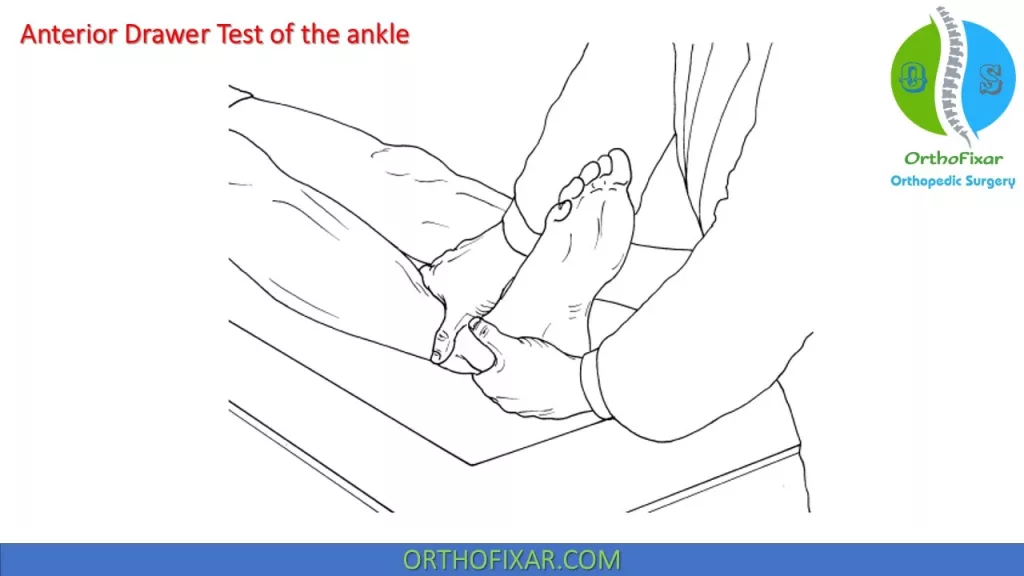 anterior drawer test ankle positive