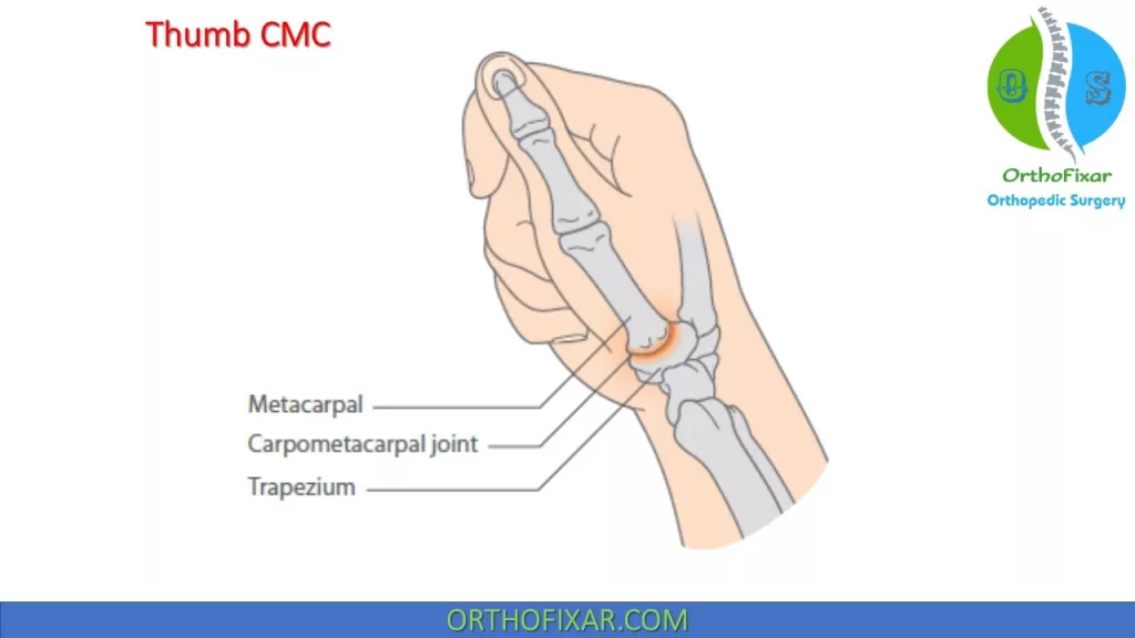CMC joint