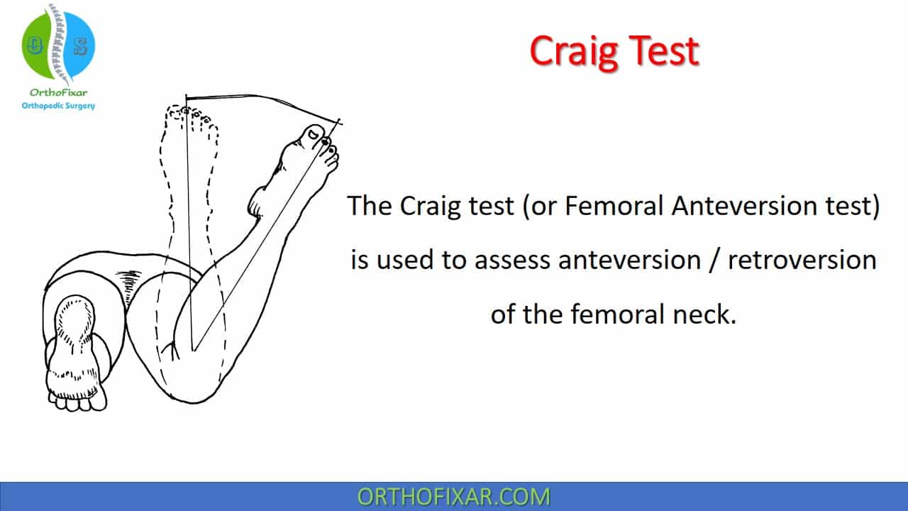  Craig Test | Hip Anteversion 