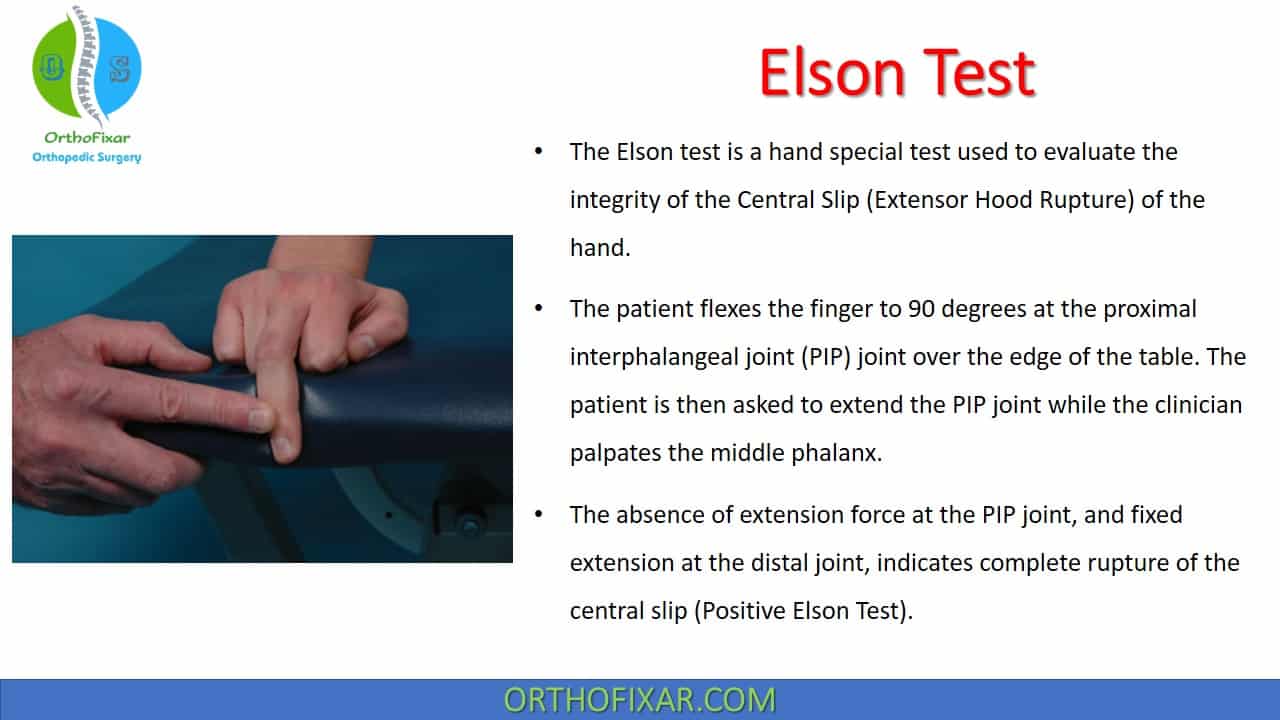  Elson Test 