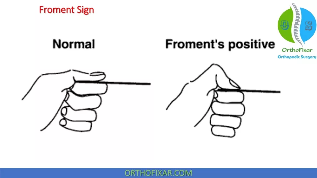 Froment Sign