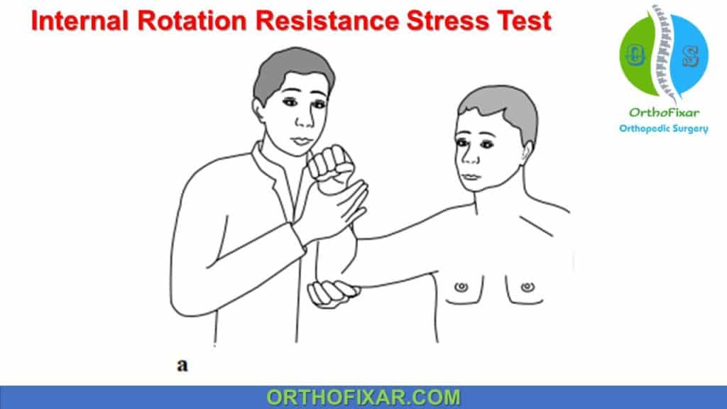 Internal Rotation Resistance Stress Test