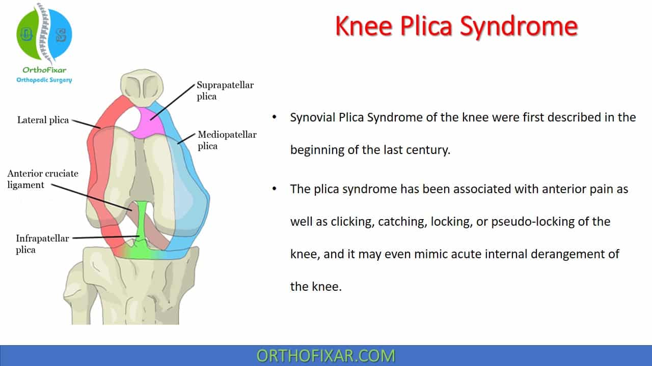 Knee Plica Syndrome 