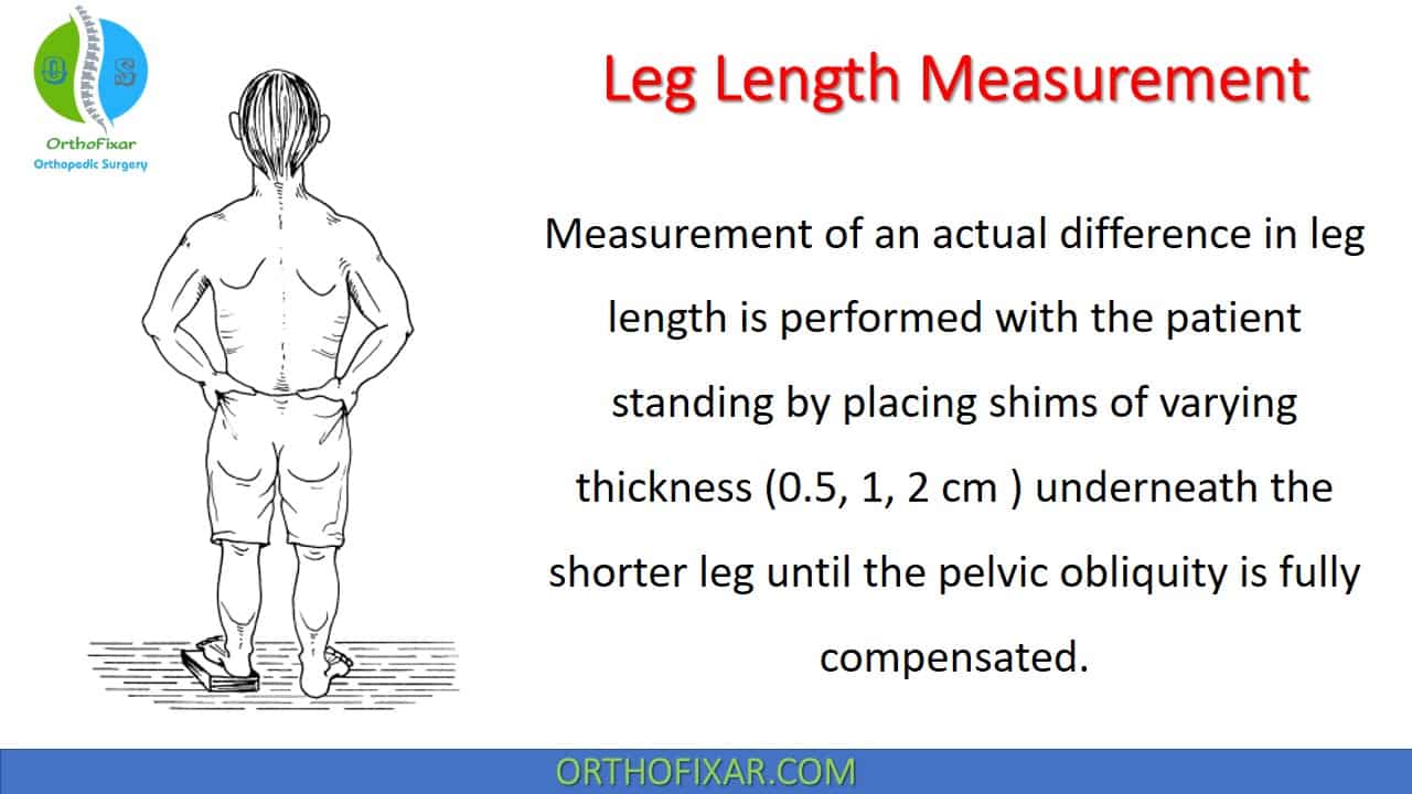  Leg Length Measurement 