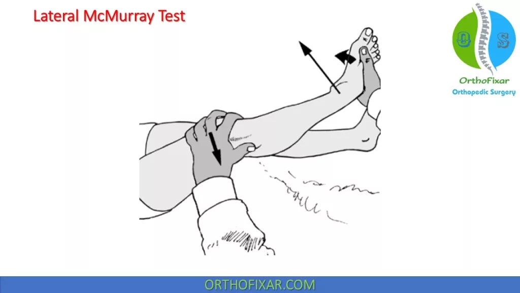 Lateral McMurray Test