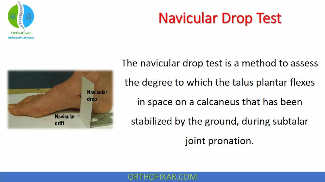  Navicular Drop Test 