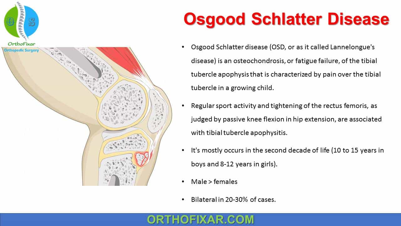  Osgood Schlatter Disease 