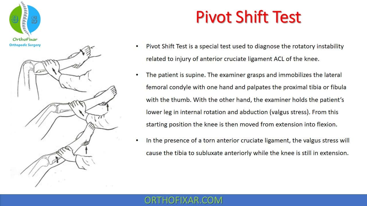  Pivot Shift Test 
