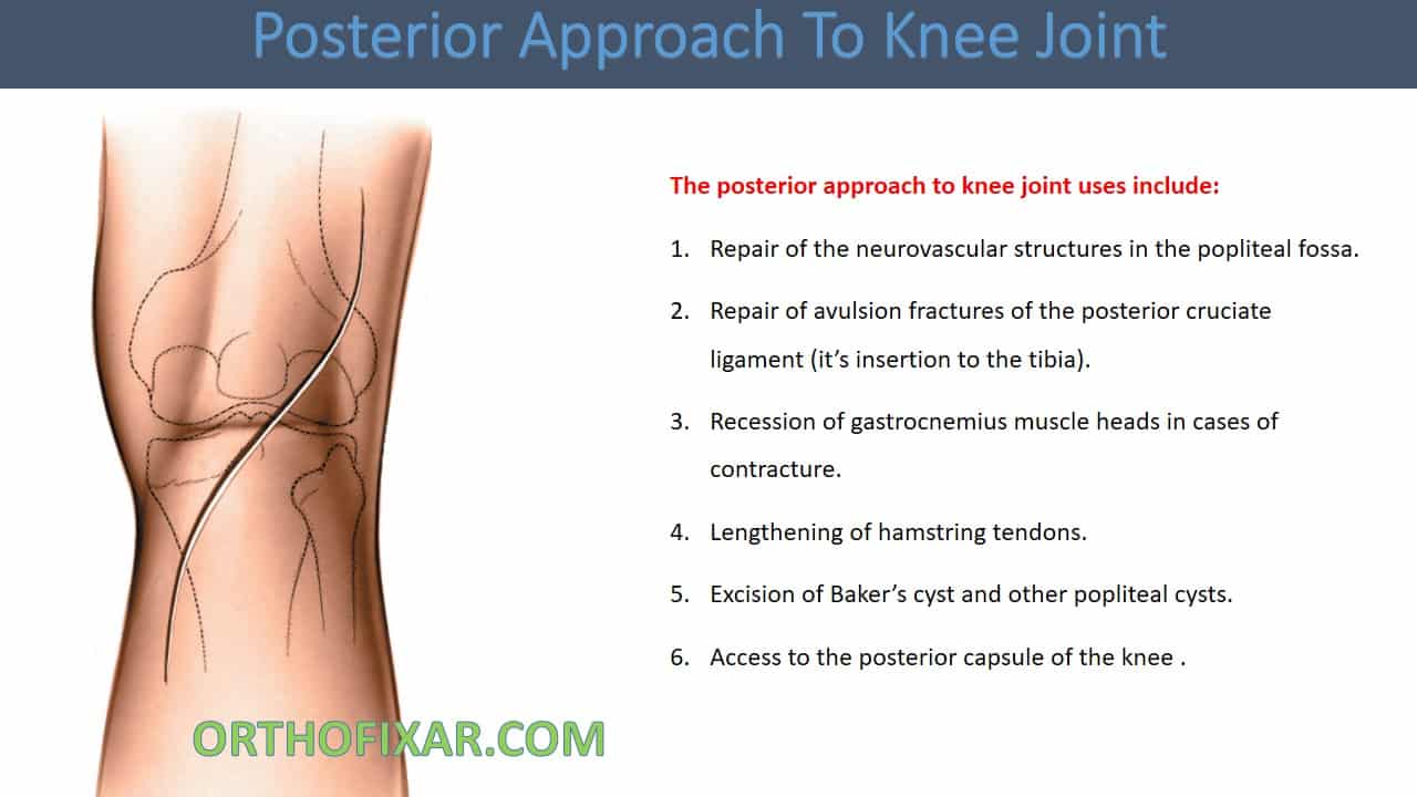  Posterior Approach To Knee Joint 