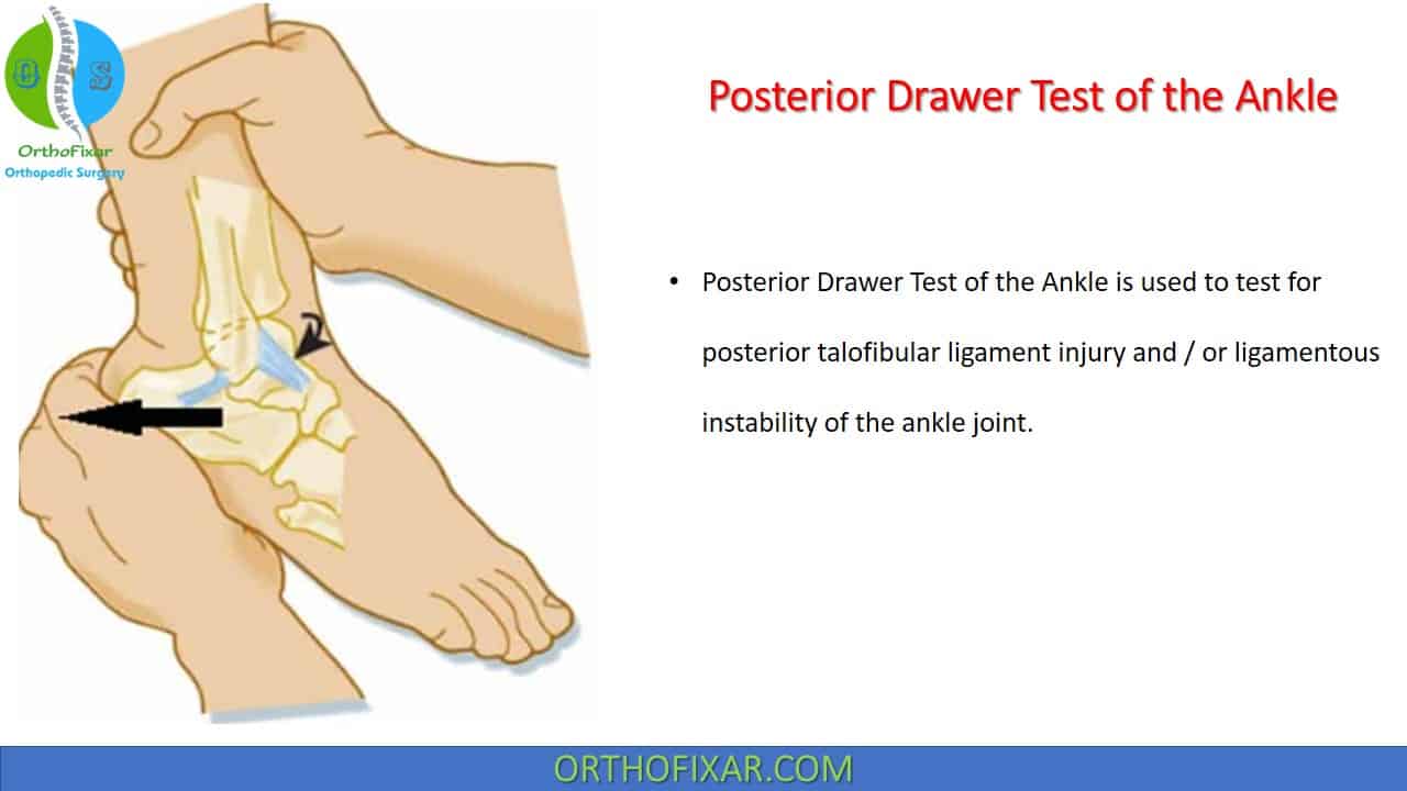  Posterior Drawer Test of the Ankle 