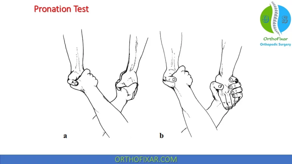 Pronation Test