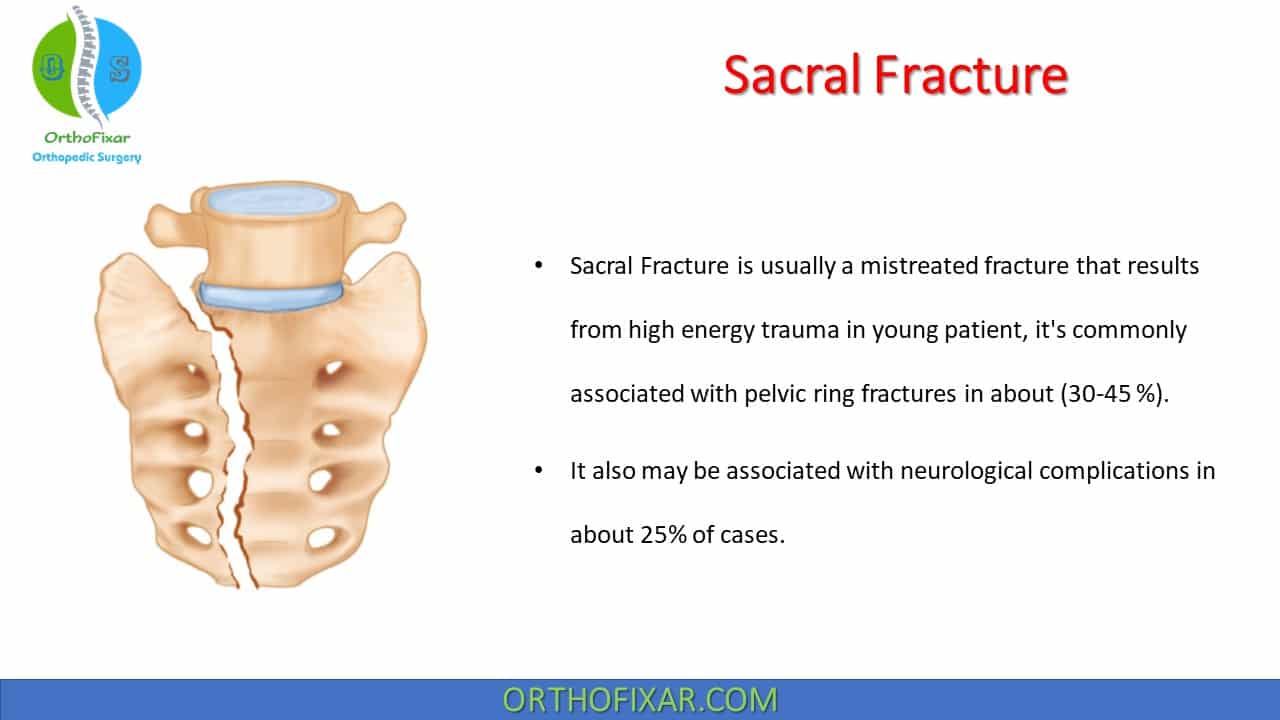  Sacral Fracture 