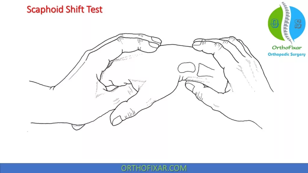 Scaphoid Shift Test