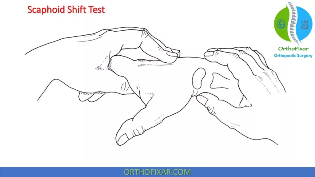 Scaphoid Shift Test - Watson Test