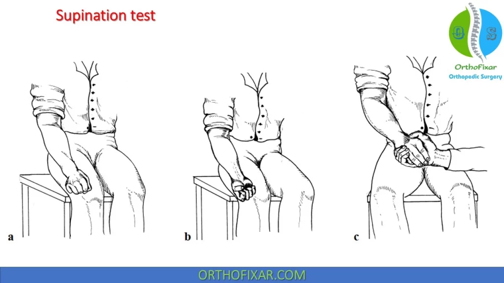 Supination Test