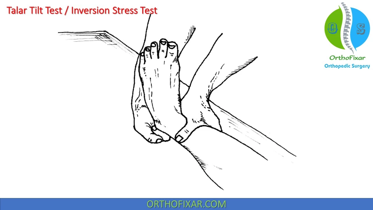 Talar Tilt Test Definition What For Easy Explained 2021 Orthofixar