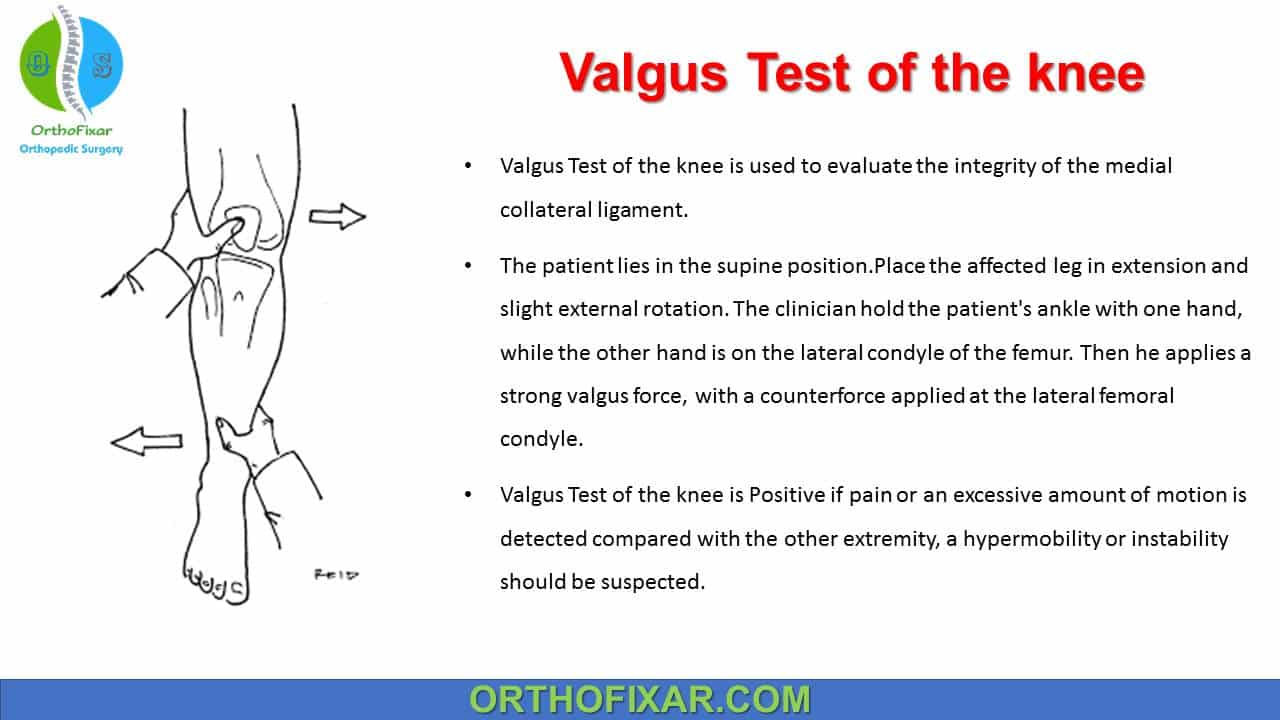  Valgus Test of the knee 