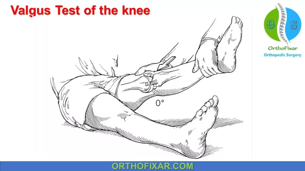 Valgus Test of the knee