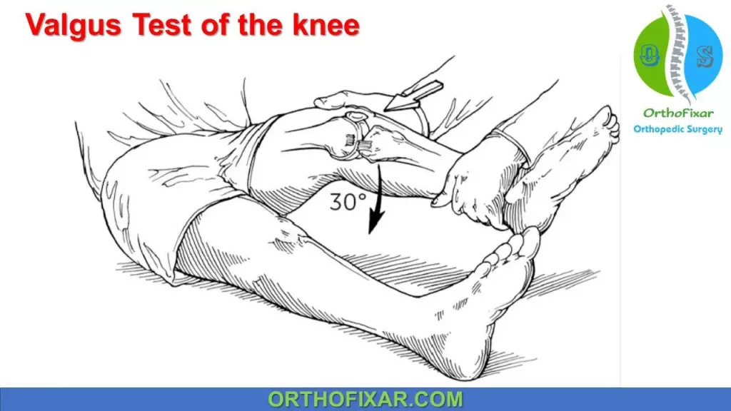 Valgus Test of the knee