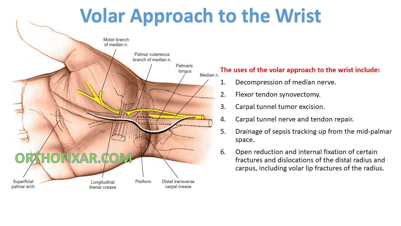  Volar Approach to the Wrist 