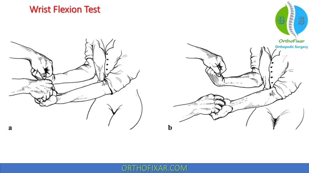 Wrist Flexion Test