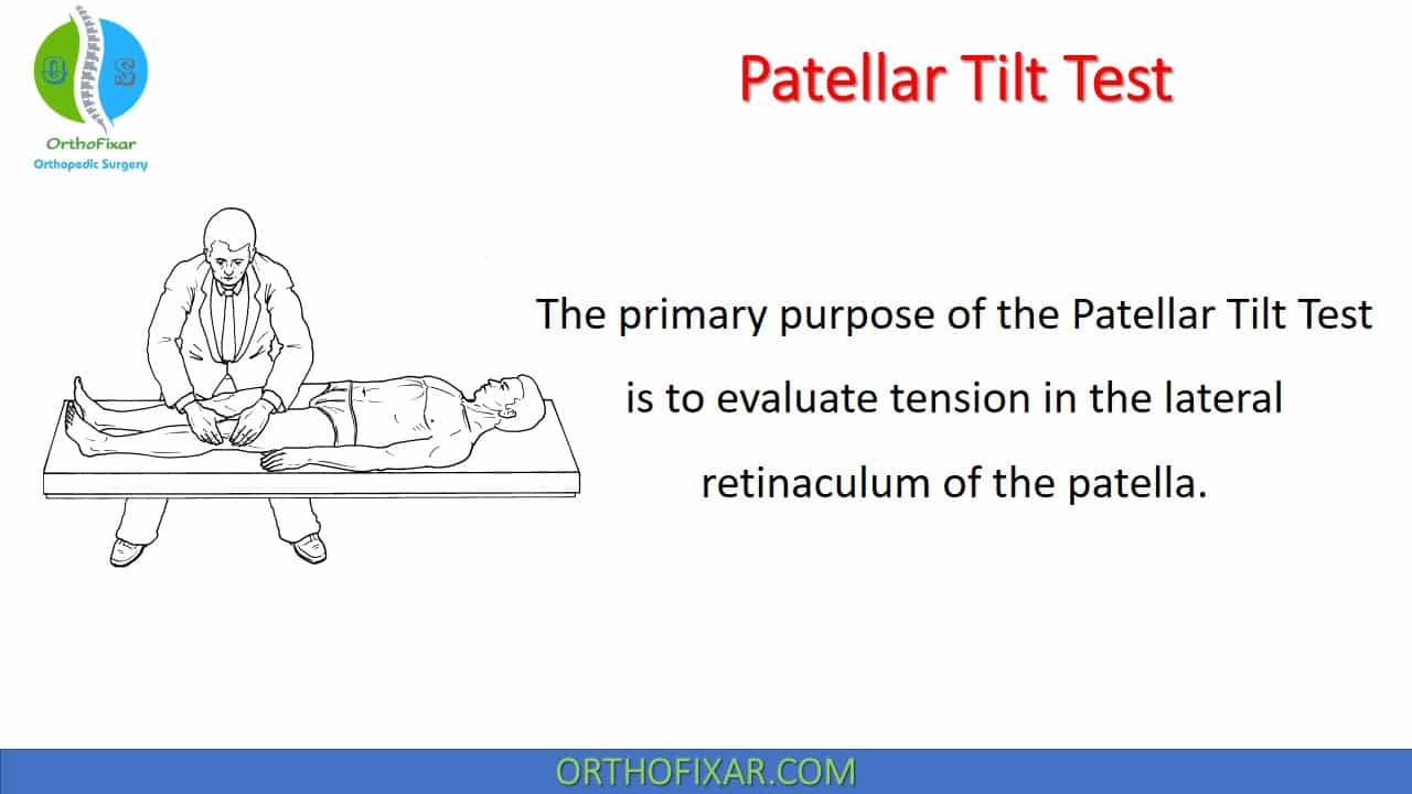  Patellar Tilt Test 
