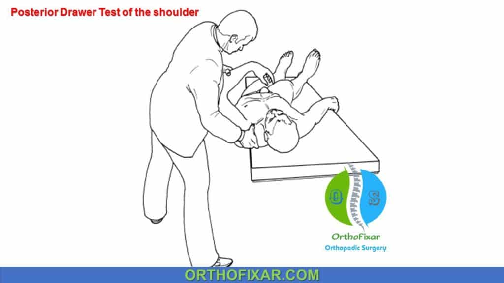 posterior drawer test shoulder